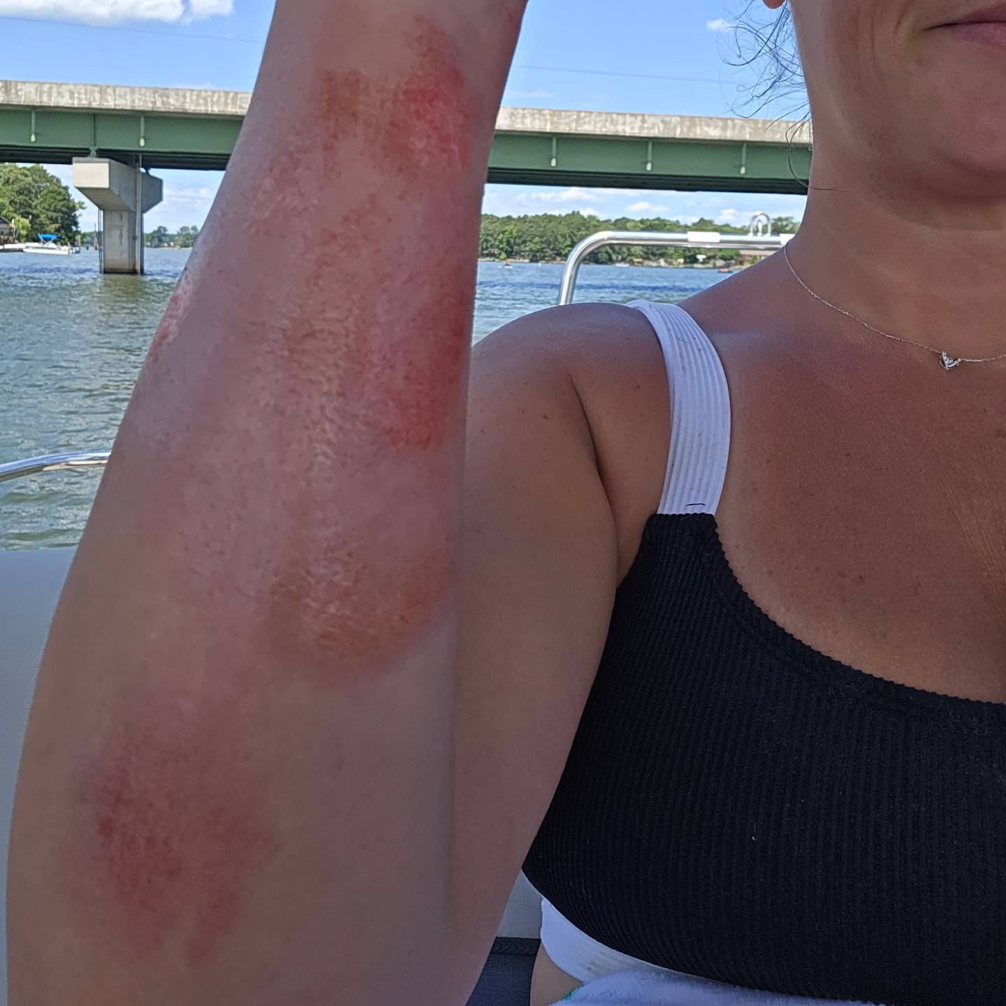 Close view of Nikki's scraped forearm on the boat, a bridge across the water behind.