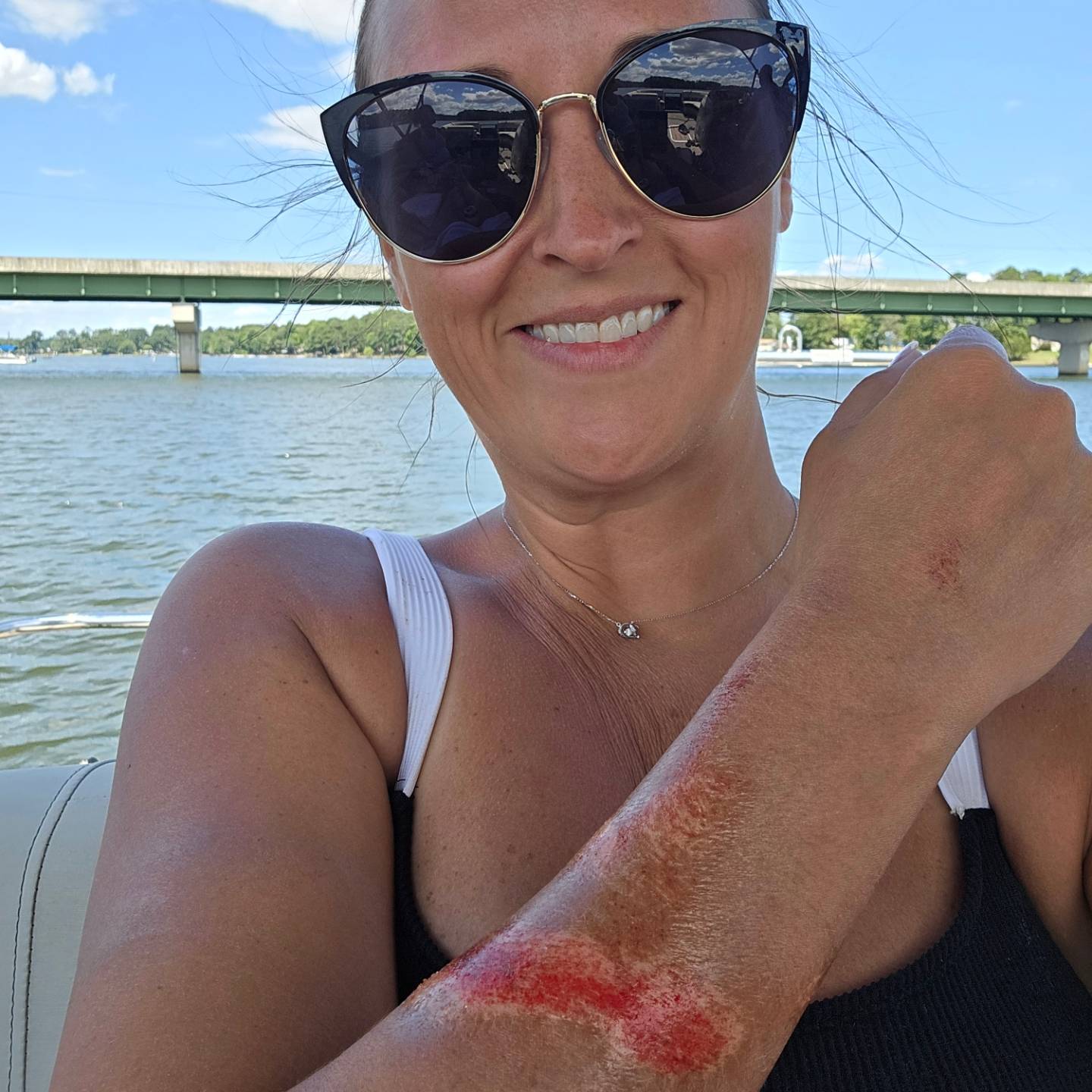 Nikki smiling in sunglasses on a boat, holding up her forearm scraped raw from noodling.
